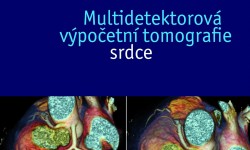 srdce_hr