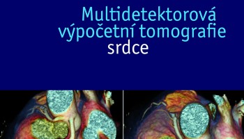 srdce_hr