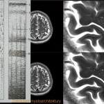 Zobrazení mikrostruktury mozkové tkáně - v porovnání s histologickým schématem jednotlivých vrstev(vlevo)